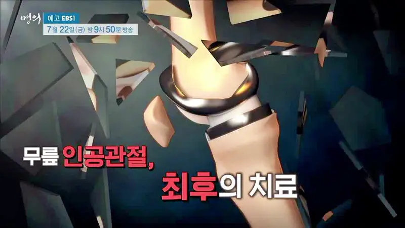 명의 수술 없이 무릎을 오래 쓸 마지막 기회 새 무릎으로 사는 법 치료법 정형외과 인용 교수, 재활의학과 이종인 교수