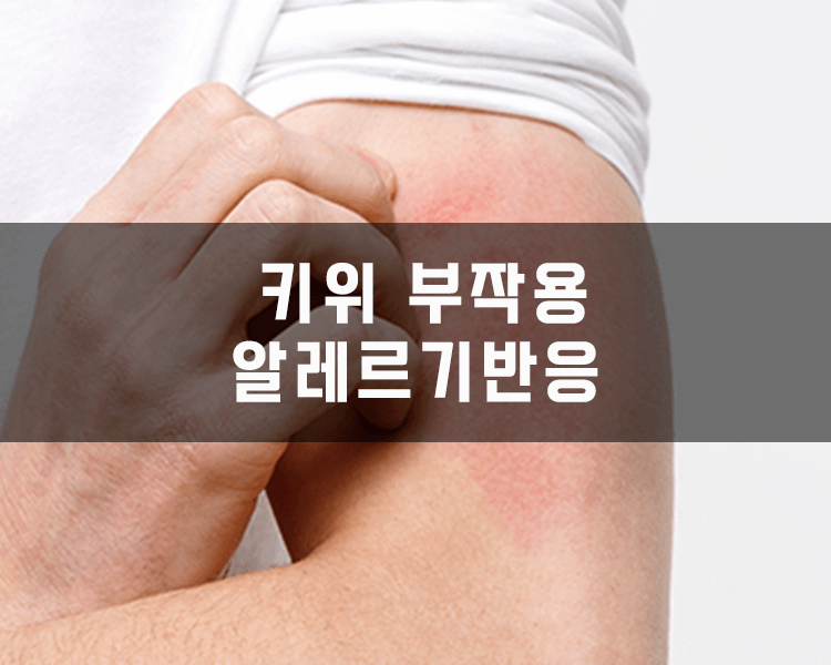 키위 부작용 - 알레르기반응