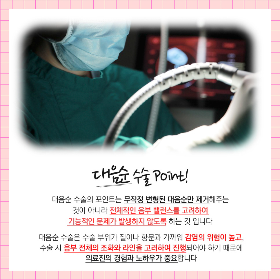 대음순수술 포인트