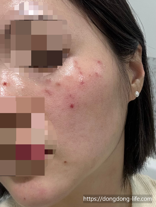 중계의원 기미 리뷰