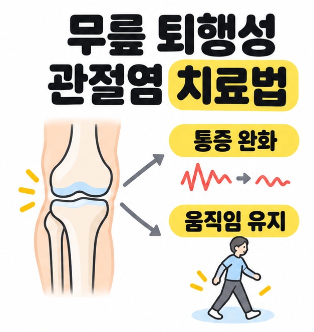 무릎 퇴행성 관절염 치료법 제목과 무릎 그림에서 통증 완화와 움직임 유지로 연결되는 치료 목표 도식