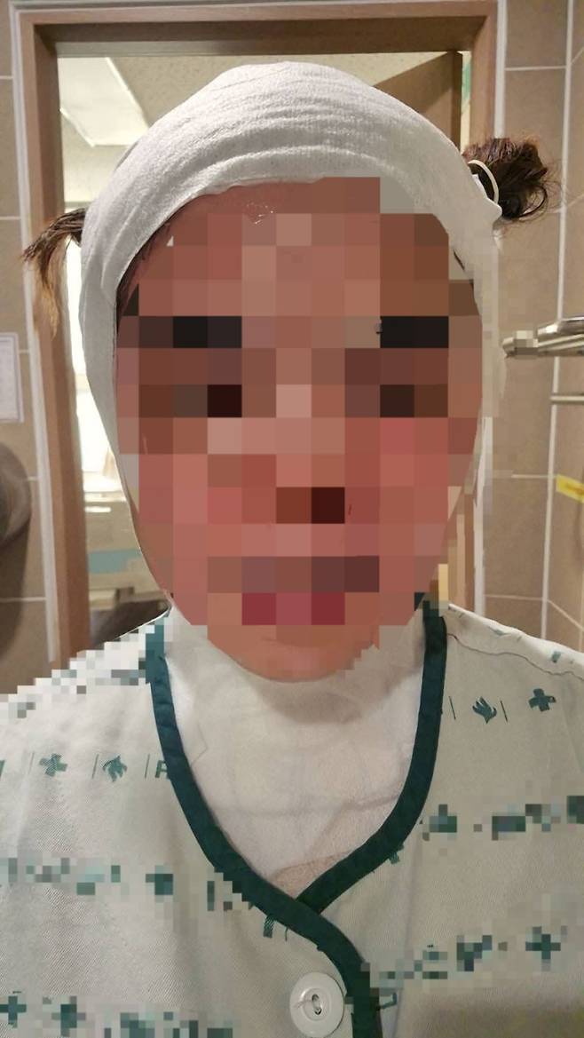 태국인 아내에 대한 폭력 사건 ❘ 끓는 물 화상 ❘ 남편 누구?