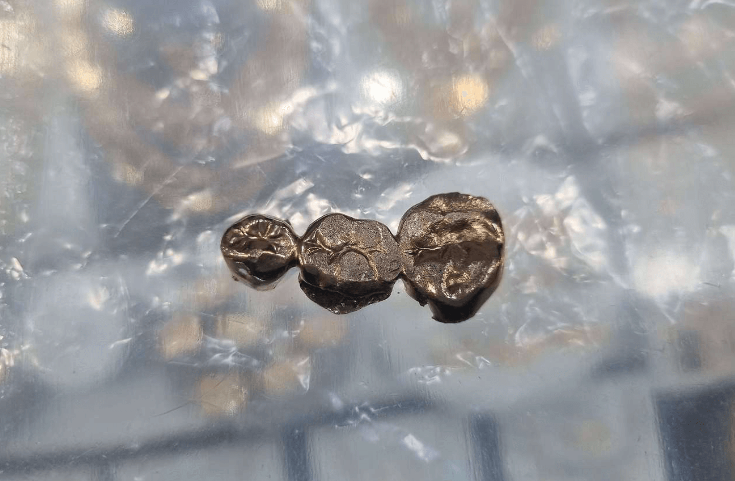 금니 매입 가격