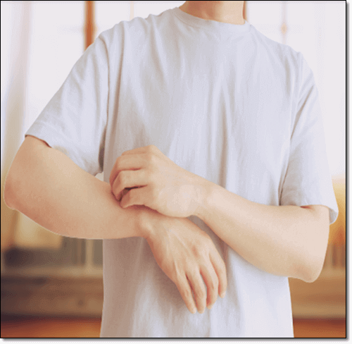 히스타민 불내증 원인 및 증상과 치료 관리