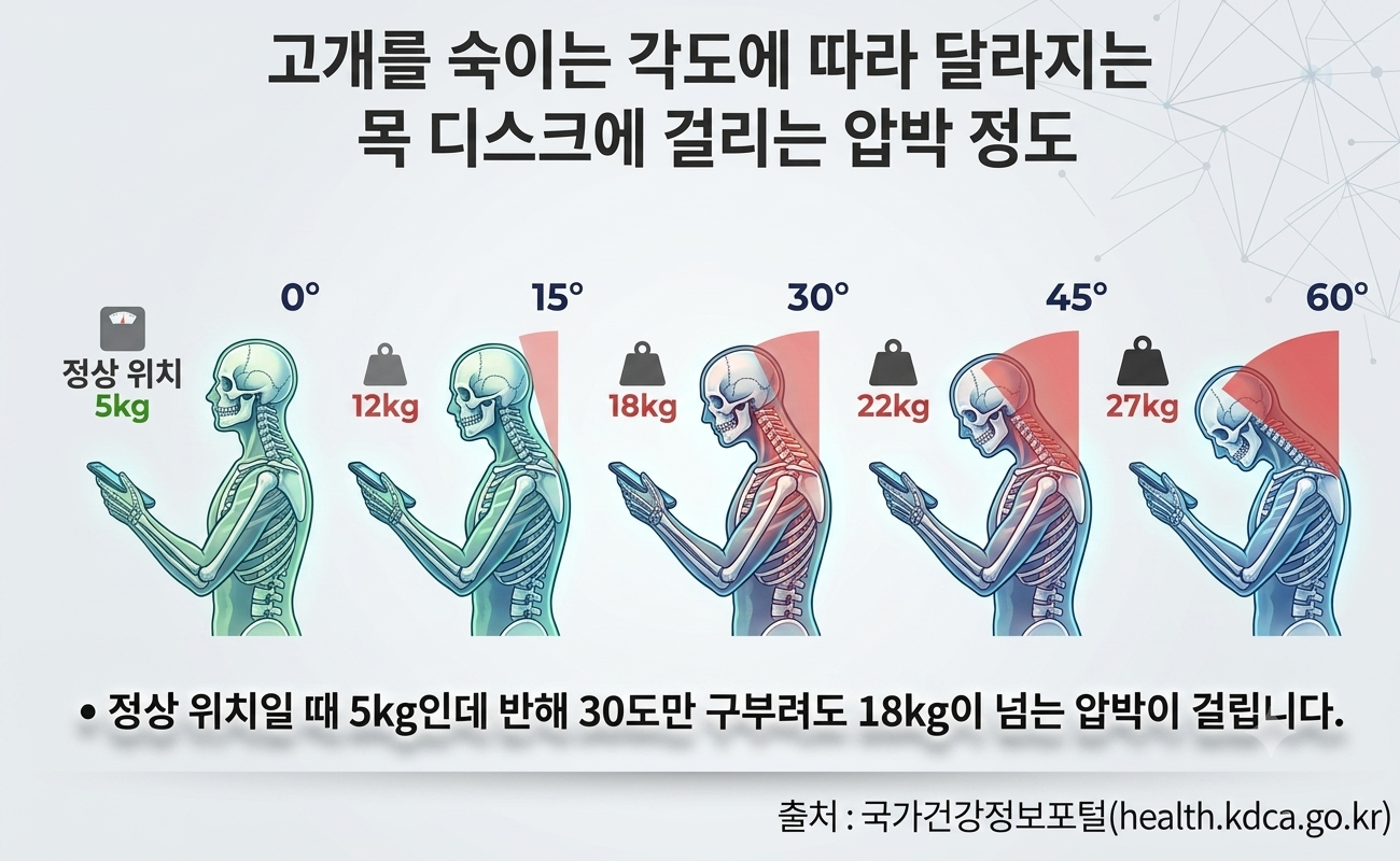 목 디스크 (방사통, 은근한 힘, 척추 위생, 신전 동작)
