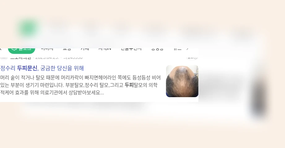 두피 문신_1_subsection