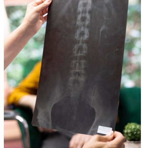 허리가 뻐근하고 땡길 때, 디스크가 아닐 수도