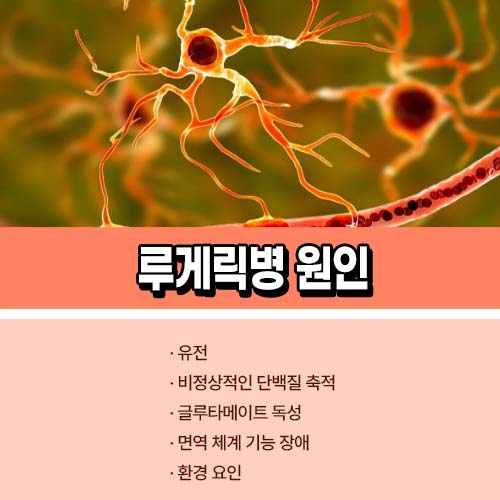루게릭병 원인