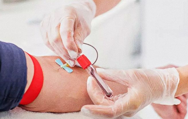 크레아티닌 수치가 높으면