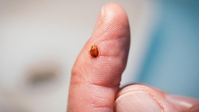 알트태그-프랑스 르몽드지에 실린 빈대 사진