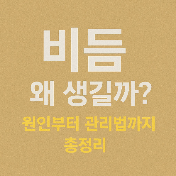 비듬 관리법