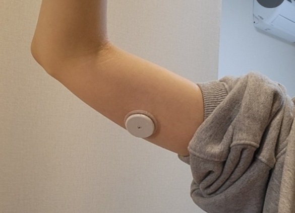 연속혈당측정기