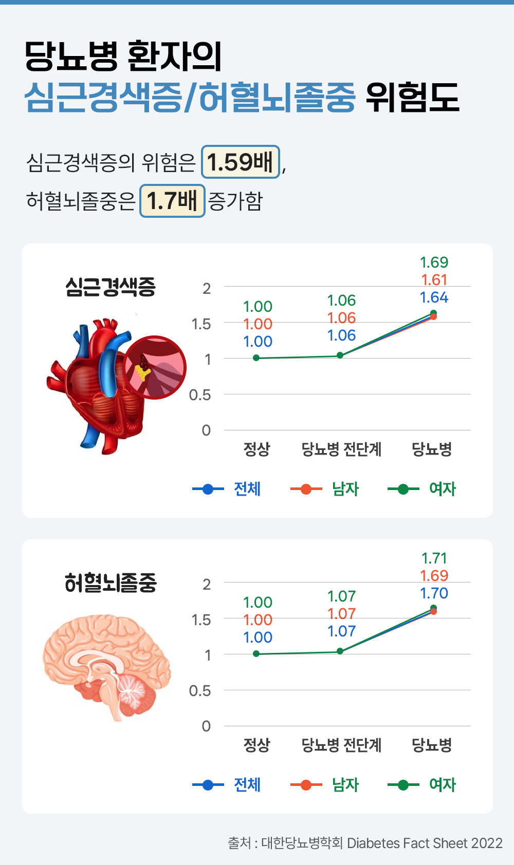 #당뇨병 환자의 심근경색증과 허혈뇌졸중 위험도