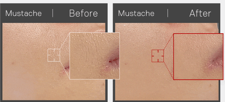 뷰앤디 눈썹 잔털 지우개