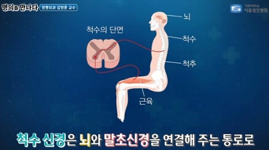 척수신경
