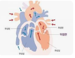 강아지 심장병 어떻게 관리 하나요?