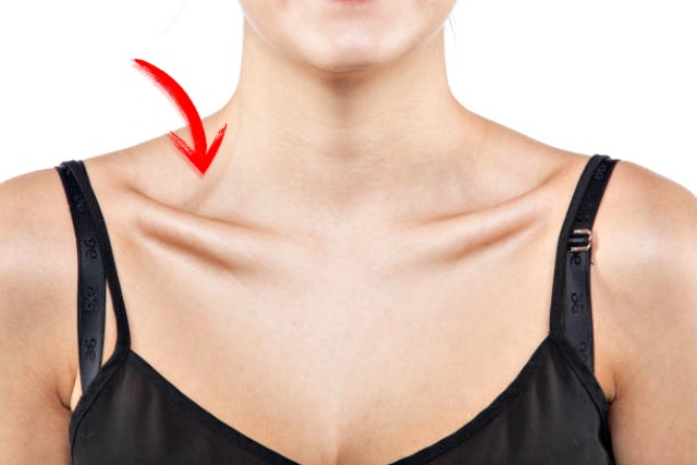 쇄골라인 만들기, 몸매교정, 척추측만 교정 운동법