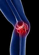 콘드로이친_1200mg