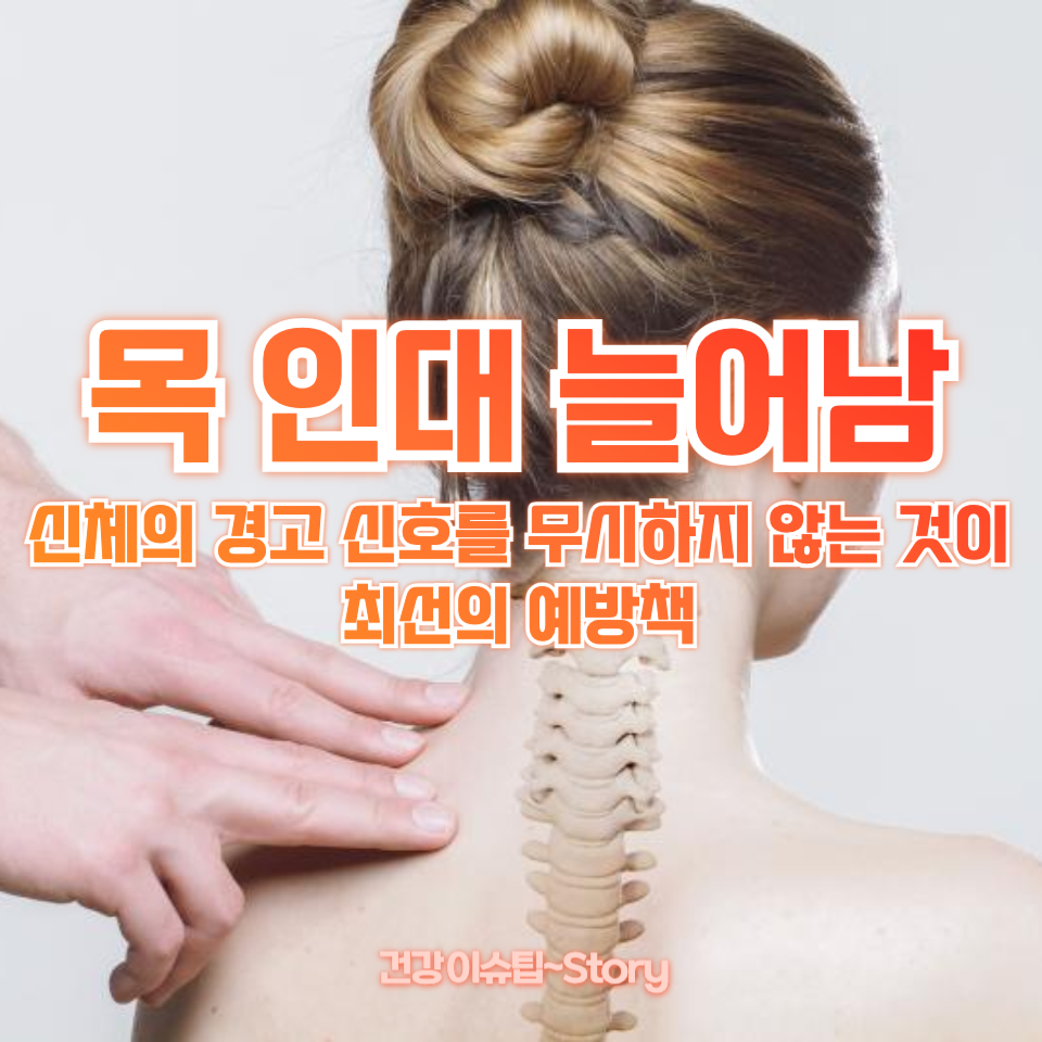 목 인대 늘어남