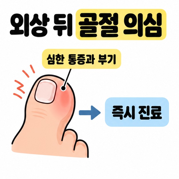 외상 뒤 골절 의심 제목 아래 붓고 아픈 엄지발가락 그림에서 화살표가 즉시 진료 문구로 이어지는 안내
