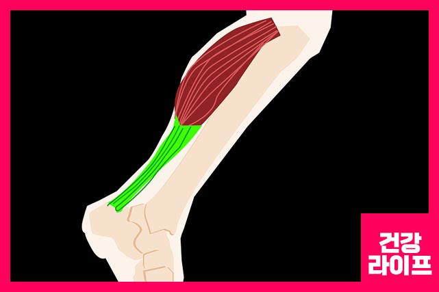 근육이 긴장되면 종아리 근육 부위에 갑작스럽게 쥐가나는 날카로운 통증과 압박을 경험