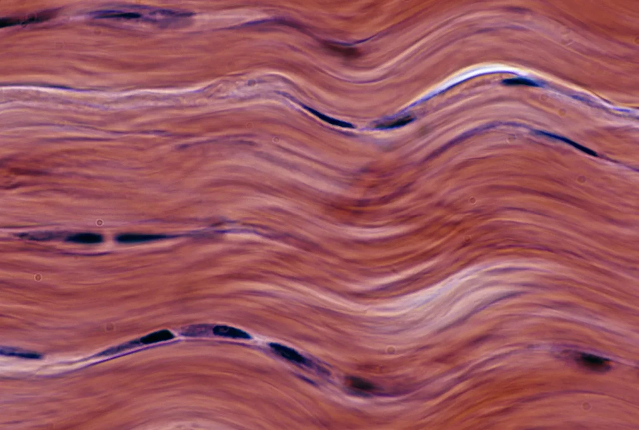 Dense Fibrous Connective Tissue.
Ed Reschke / Photolibrary / Getty Images