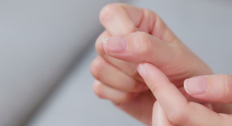 손톱 검은 세로줄