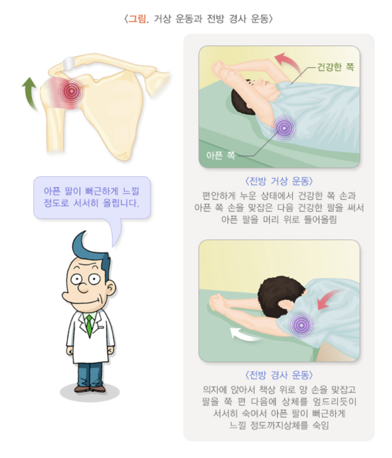 거상운동