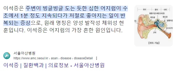 이석증 증상