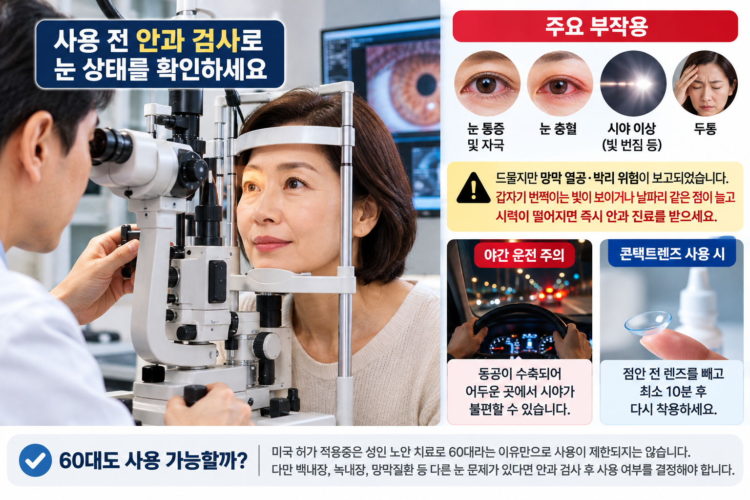 노안 치료제 유베지 주요 부작용과 안과 검사 필요성, 야간 운전 및 콘택트렌즈 사용 시 주의사항