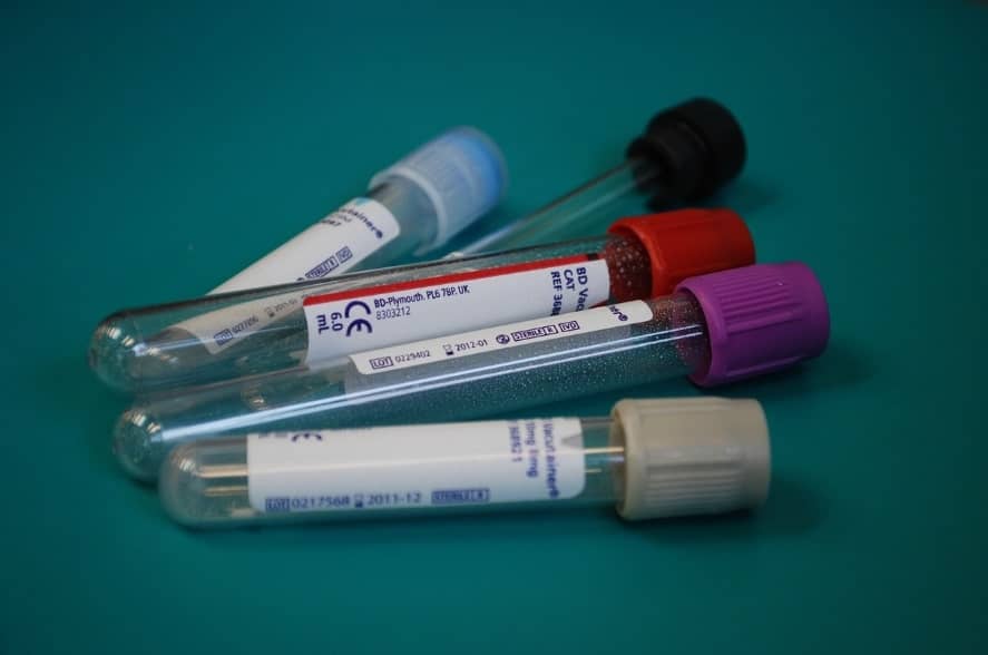 필수 산전검사 혈액검사 보틀 사진