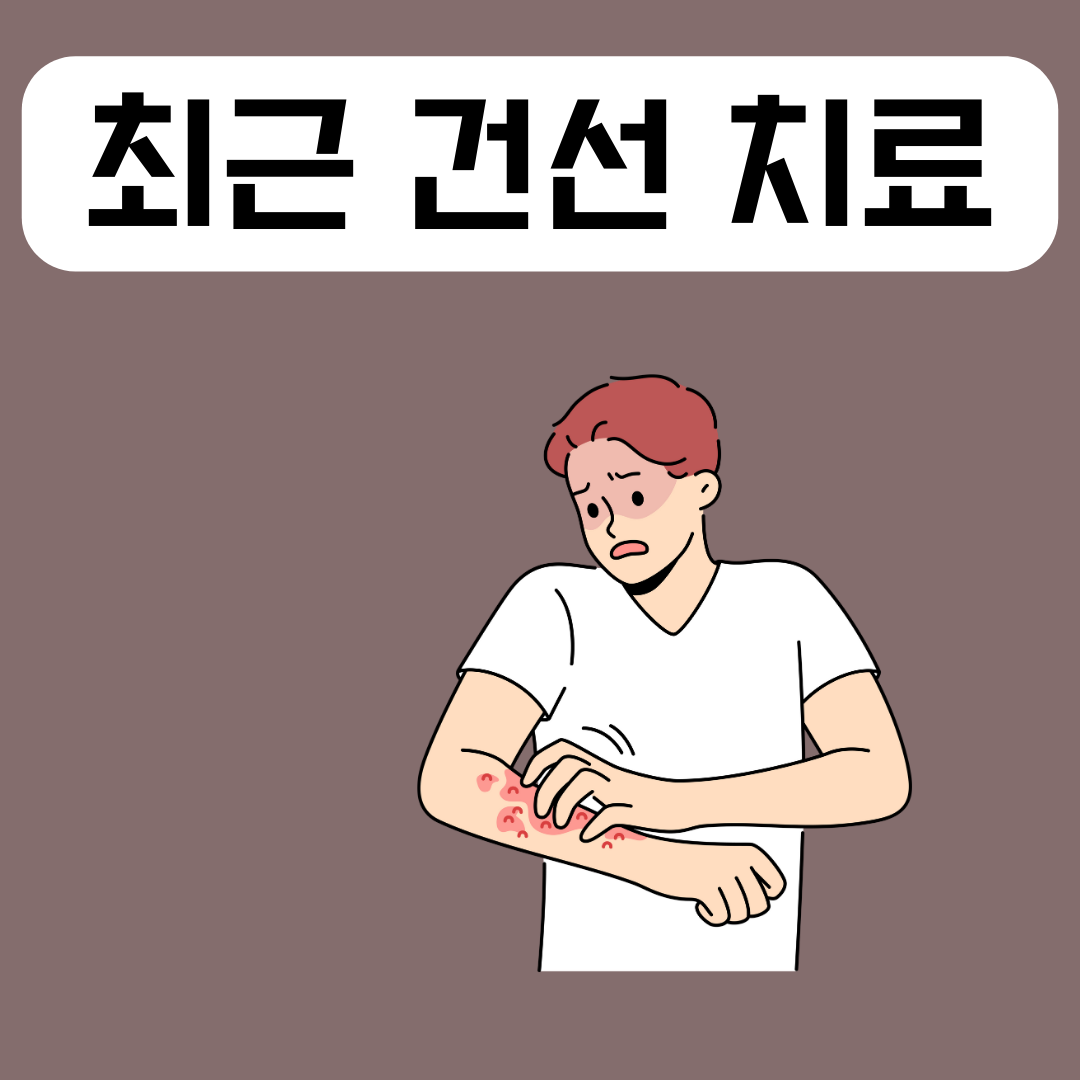 최근-건선-치료