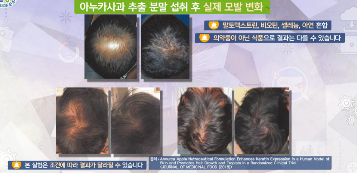 아누카 사과 분말