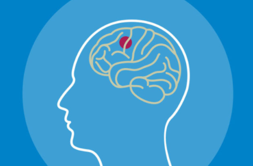 뇌질환을 앓고 있는 사람을 표현한 그림