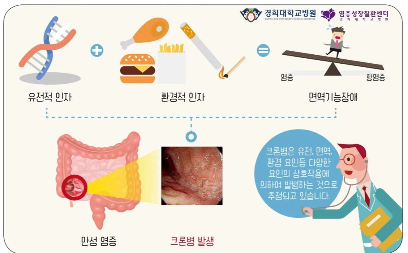크론병 증상