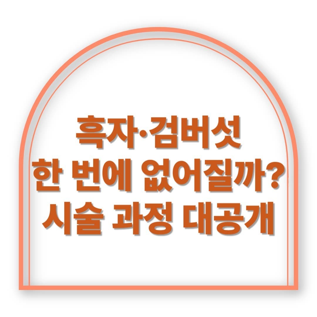 흑자·검버섯, 한 번에 없어질까? 시술 과정 대공개