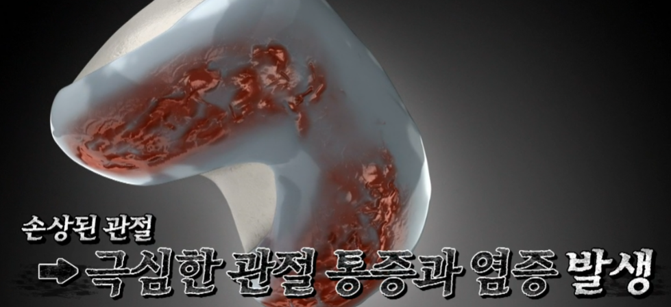콘드로이친