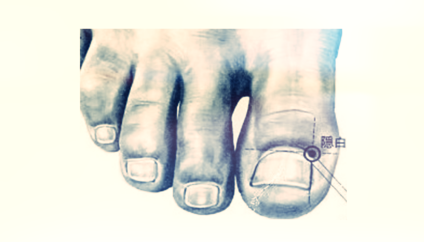 체했을때-발가락따는법