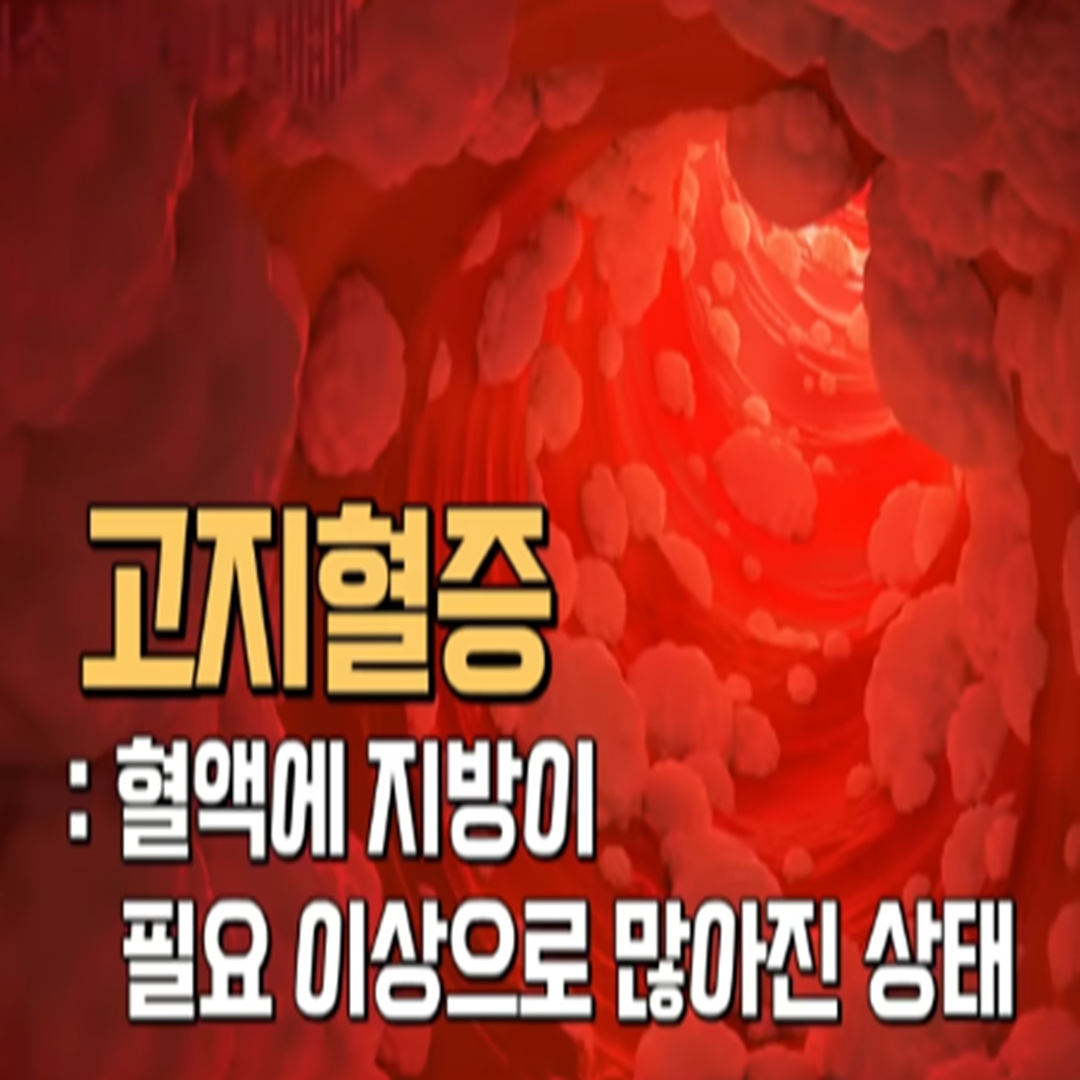 고지혈증 약 없이 건강한 혈관 만드는 법