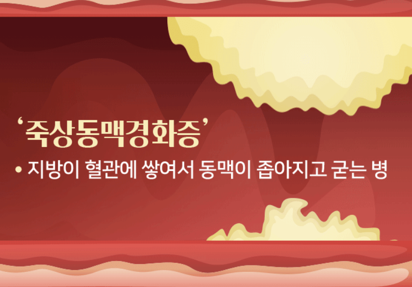 죽사동맥경화증