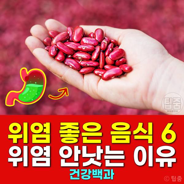 위염에 좋은 음식 위염에좋은차 위염음식