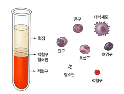 폐암 초기증상