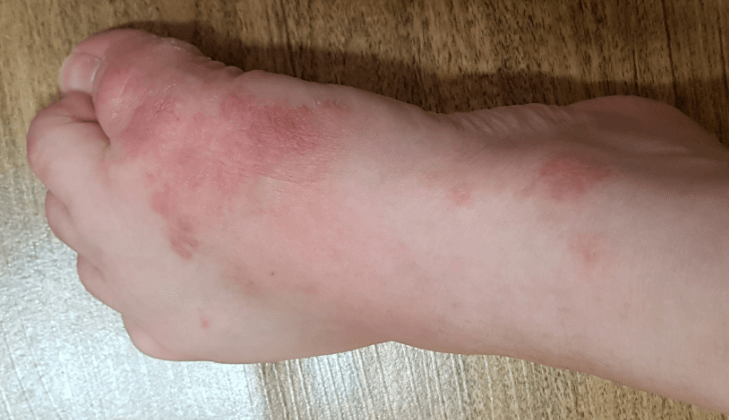 다이소-리콜-환불-받는-방법-욕실슬리퍼-유해물질