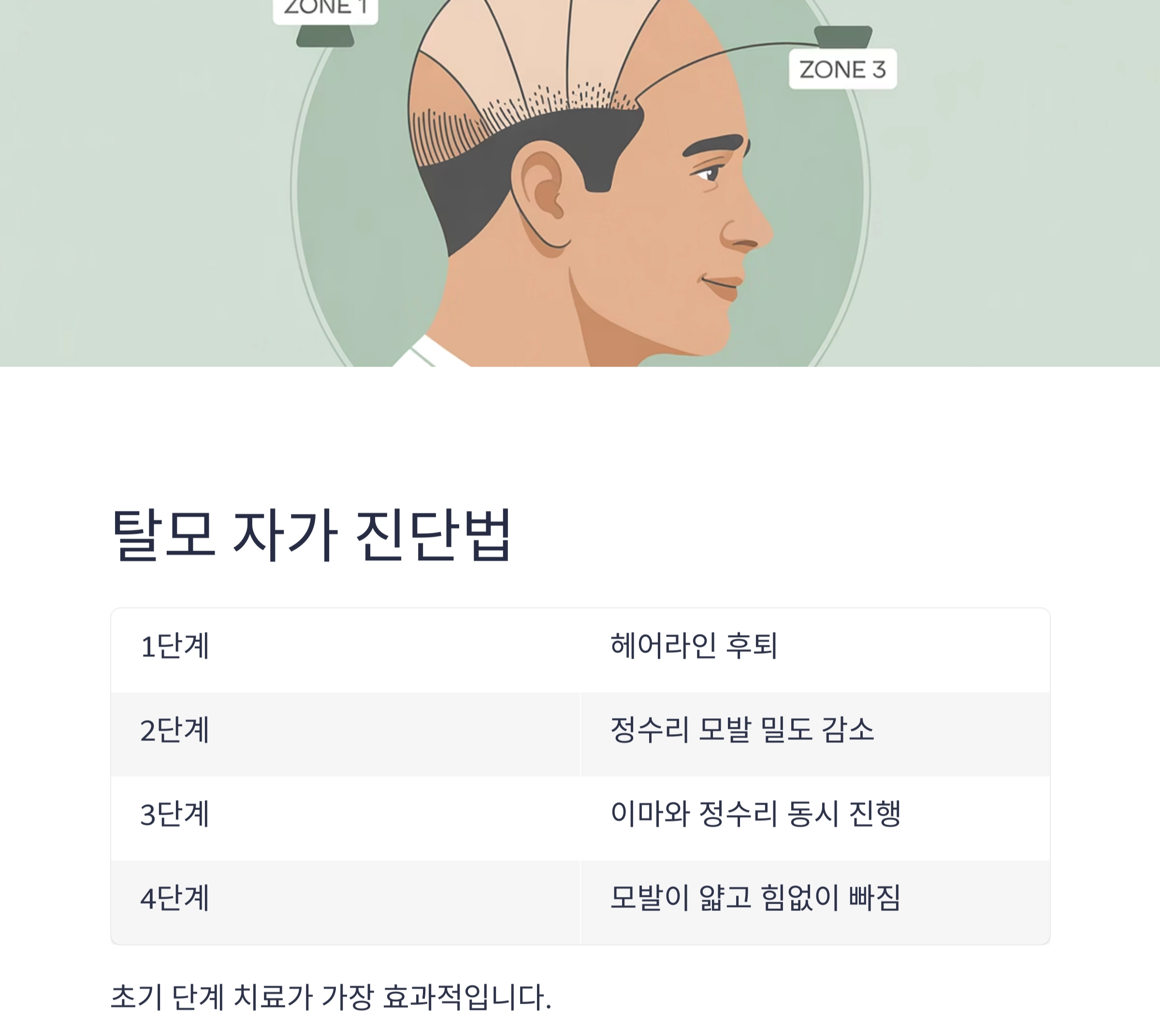 중년 남성 탈모, 과연 해결할 수 있을까? 효과적인 방법 총정리