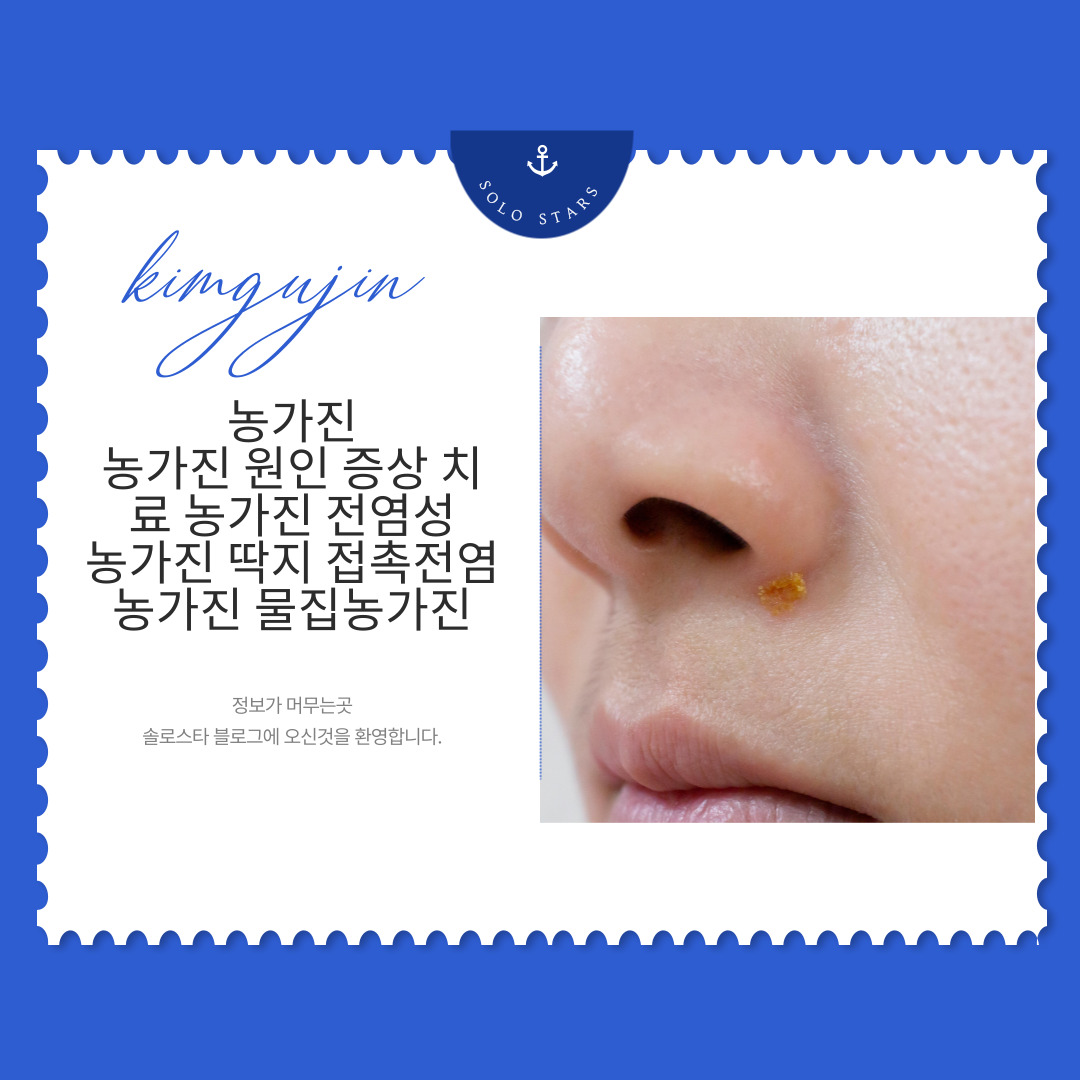 농가진 사진