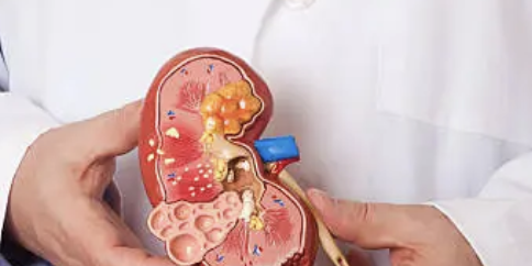 왼쪽 아랫배 통증 19