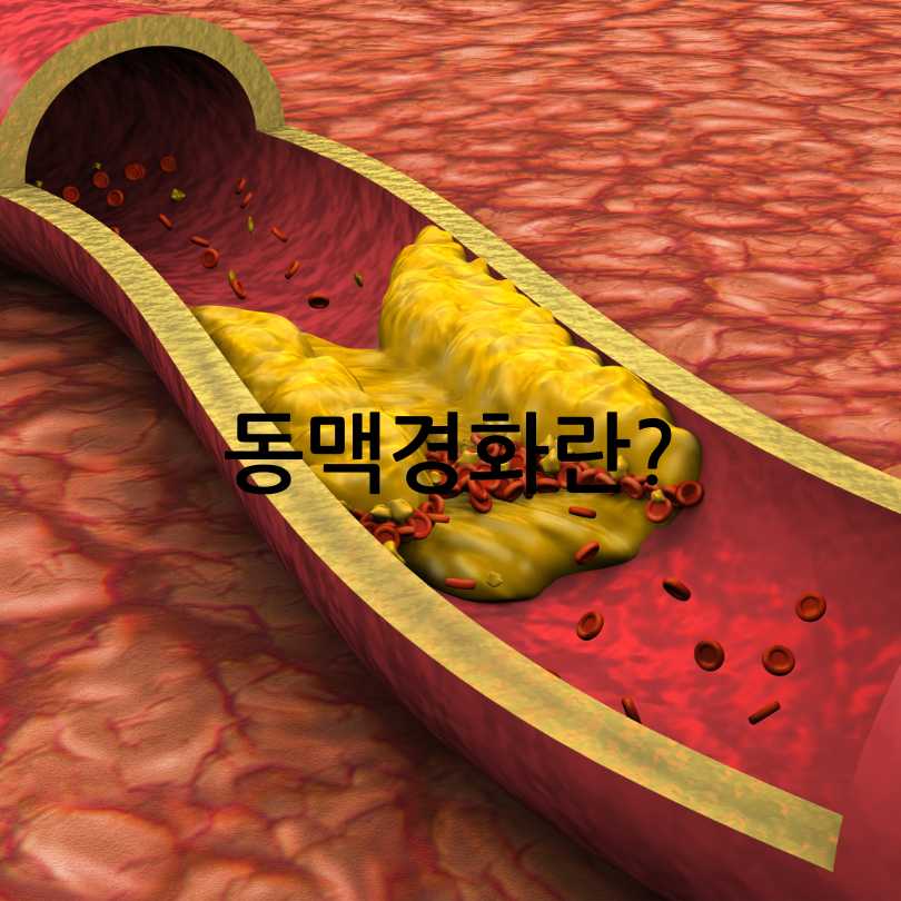 혈관건강관리