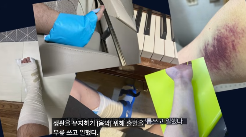 혈우병이란
