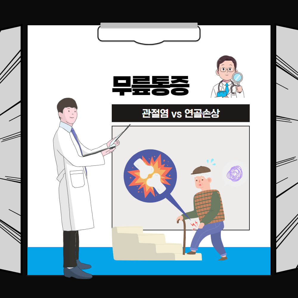 무릎통증 - 관절염 vs 연골손상