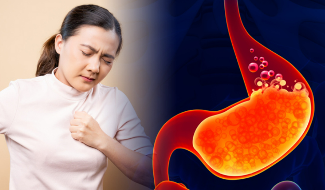 역류성 식도염 증상